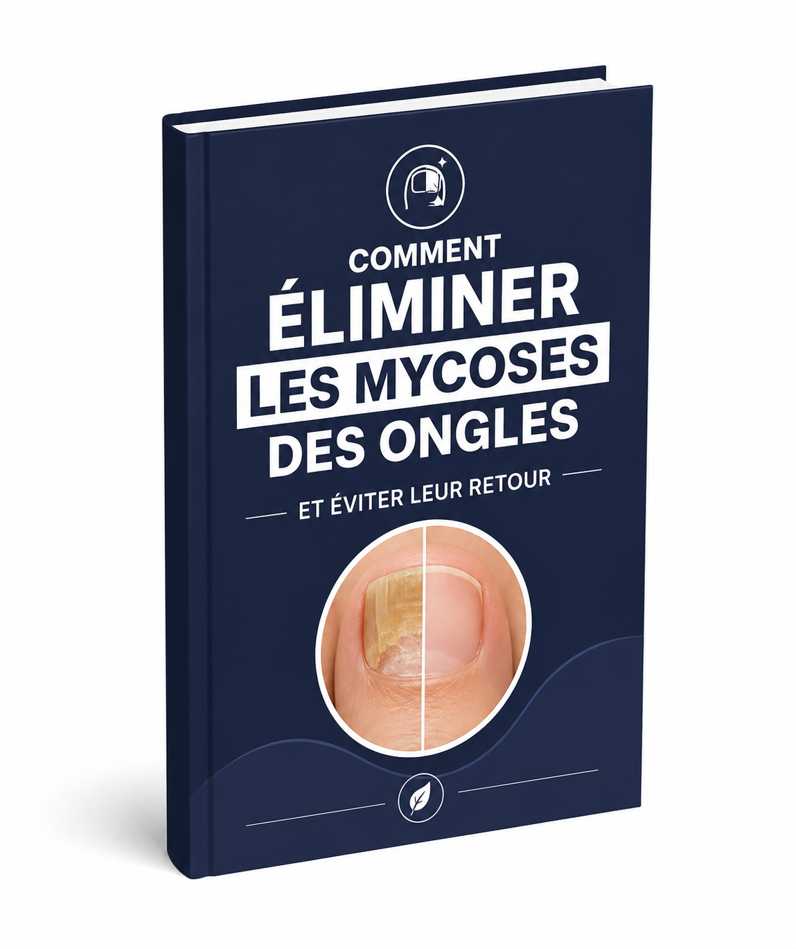 Ebook OFFERT – Comment éliminer les mycoses des ongles et éviter leur retour