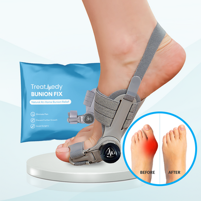 Qilova Correcteur Hallux™