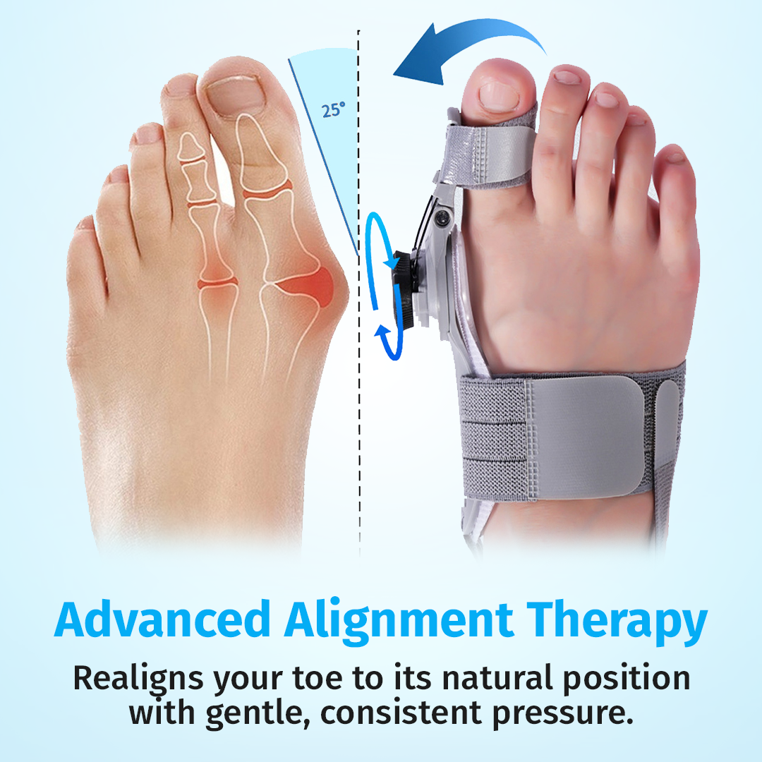 Qilova Correcteur Hallux™