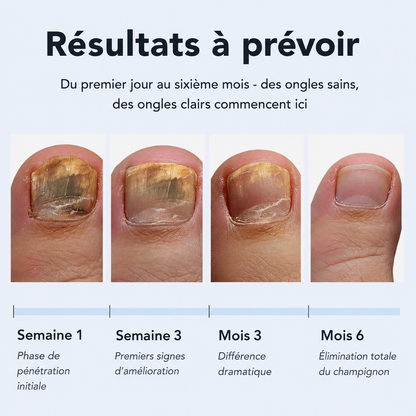 Qilova – Stylo antifongique pour ongles