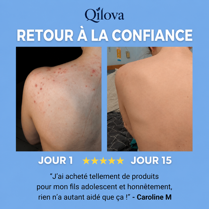 Savon Anti-Acné Dos