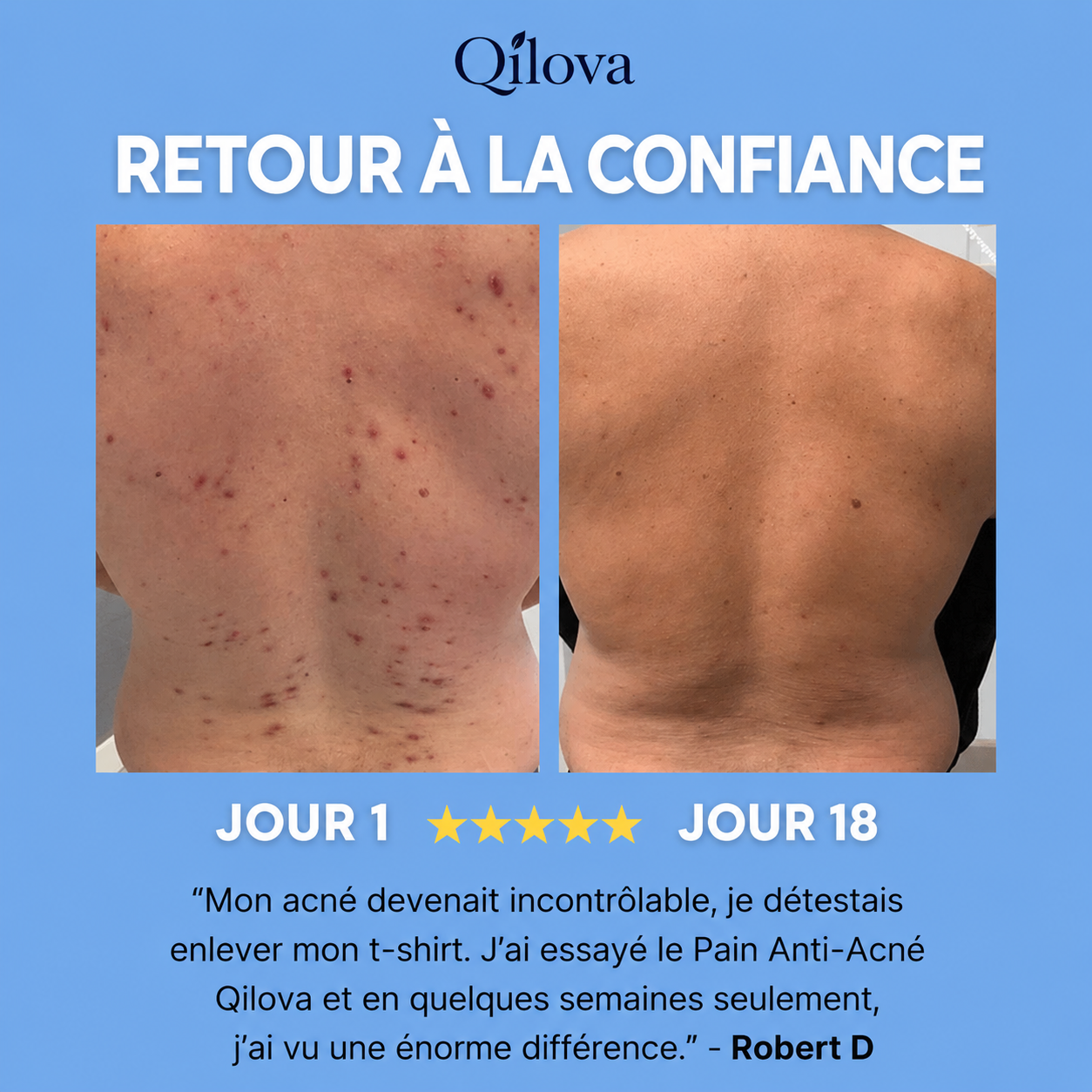 Savon Anti-Acné Dos