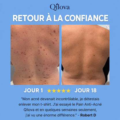 Savon Anti-Acné Dos
